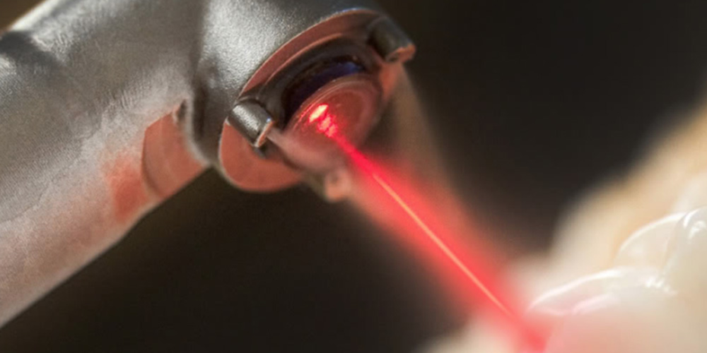 Lasers In Dentistry Their use in the Modern Dental Practice
