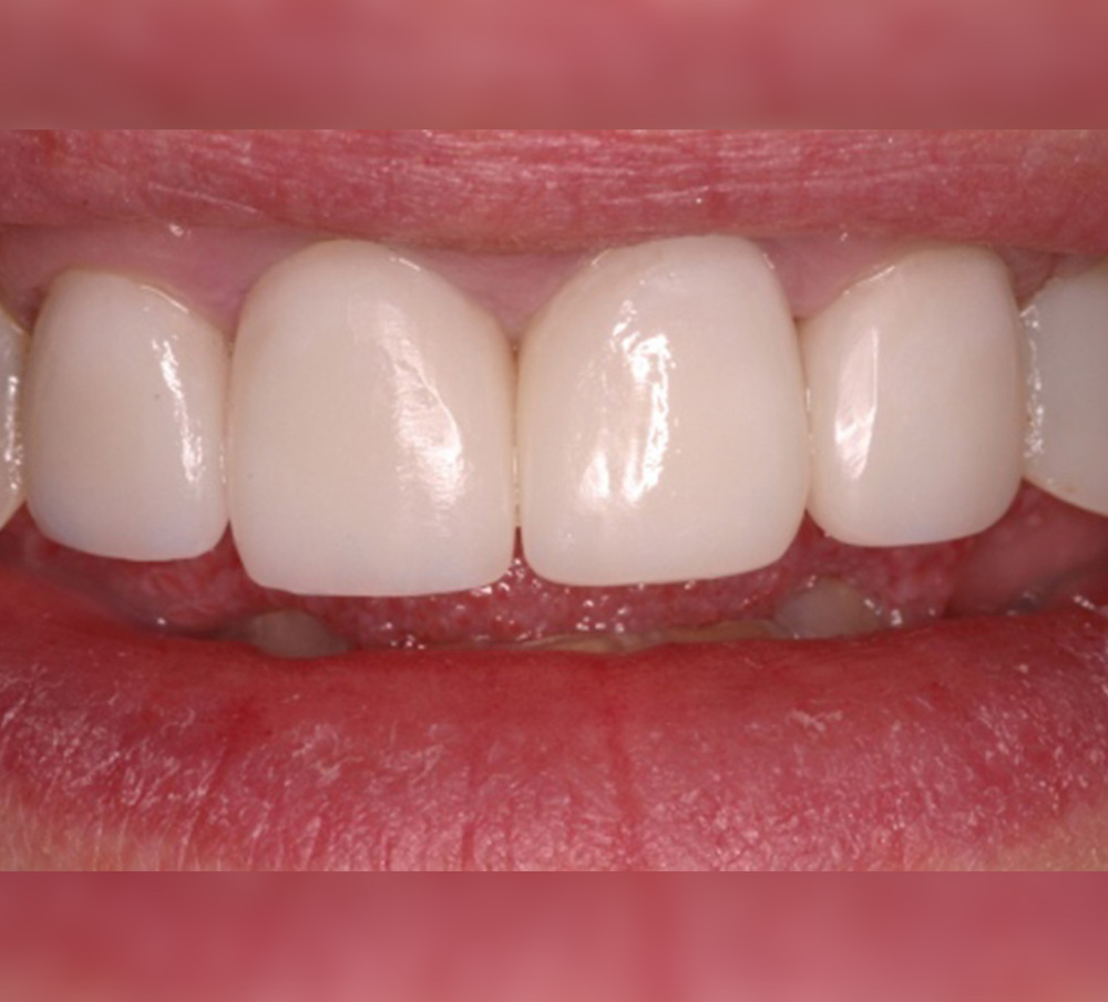 Brisbane Tingalpa Dentist Answers most commonly asked questions for